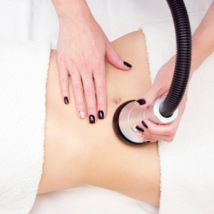 Đ&agrave;o Thải Mỡ Bụng Bằng S&oacute;ng RF