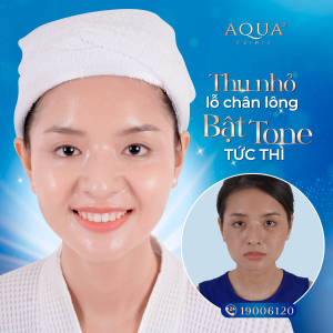 Trẻ H&oacute;a Da PRP