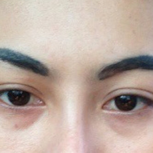 Xử L&yacute; M&agrave;y Hư Trổ Xanh Đỏ