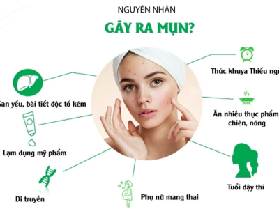 Cẩn Trọng Khi Sử Dụng Sữa Rửa Mặt Sai C&aacute;ch Đối Với Da Bị Mụn Vi&ecirc;m