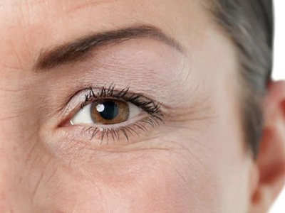 Địa chỉ x&oacute;a nhăn mắt bằng c&ocirc;ng nghệ plasma quận 12 TPHCM