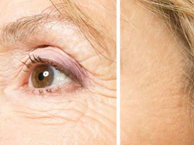 L&agrave;m trẻ h&oacute;a da mặt như thế n&agrave;o hiệu quả