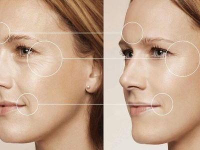 Quy tr&igrave;nh trẻ h&oacute;a da mặt PRP 