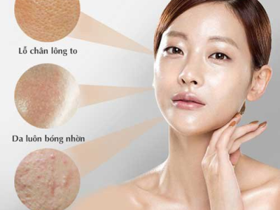 Tại Sao Da Dầu Vẫn Cần Phải Cấp Nước Để Khỏe Đẹp Từ B&ecirc;n Trong?