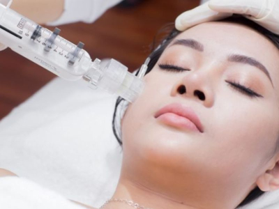 Trẻ ho&aacute; da căng b&oacute;ng l&agrave; g&igrave;? 