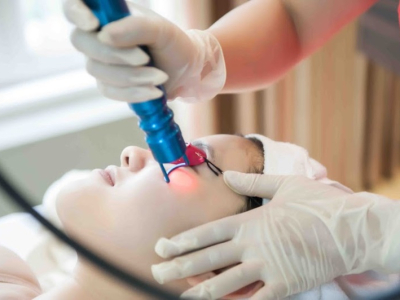 Trẻ h&oacute;a da mặt bằng tia Laser