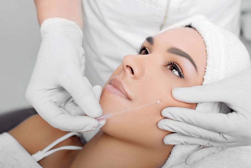 Căng chỉ trẻ hóa da mặt là gì? 