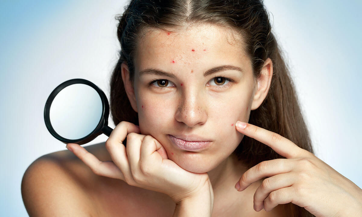 cham-soc-da-xu-ly-nhan-mun-1