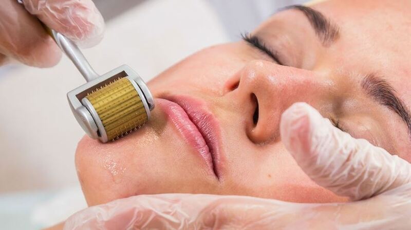Lăn kim trẻ hóa da mặt