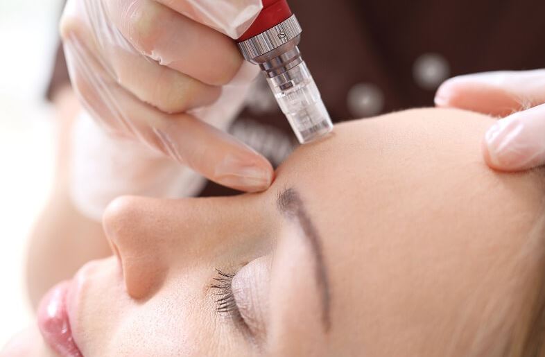 phi-kim-phuc-hoi-da-1