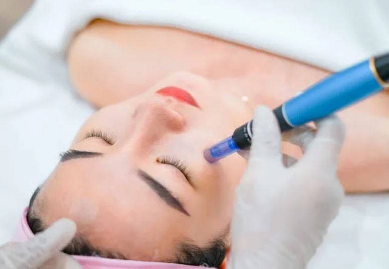 phi-kim-phuc-hoi-da-2