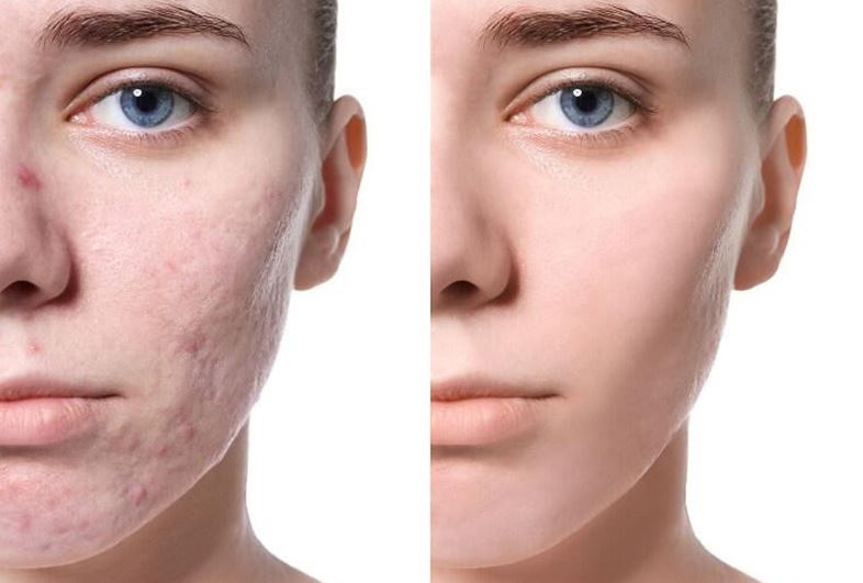 phi-kim-phuc-hoi-da-3