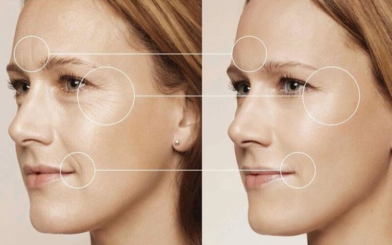 Quy trình trẻ hóa da mặt PRP