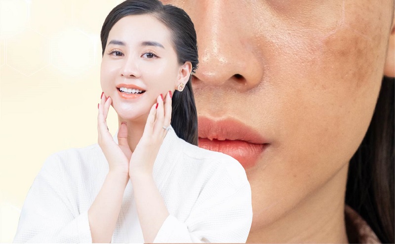 san-chac-da-voi-collagen-tuoi-2