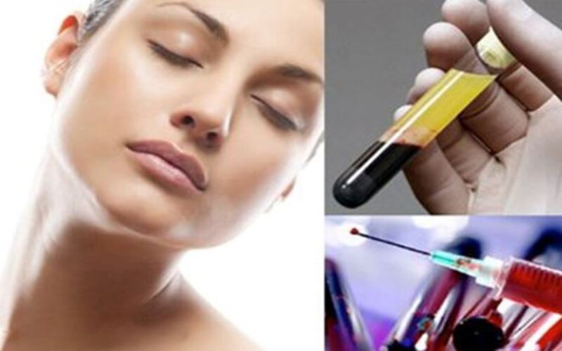 Trẻ hóa da bằng tế bào gốc tự thân 