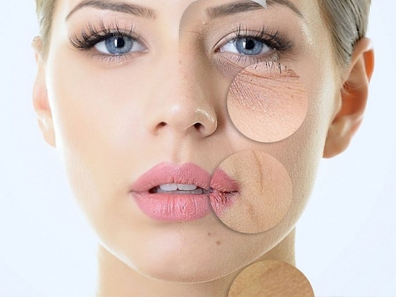 Trẻ hoá da căng bóng