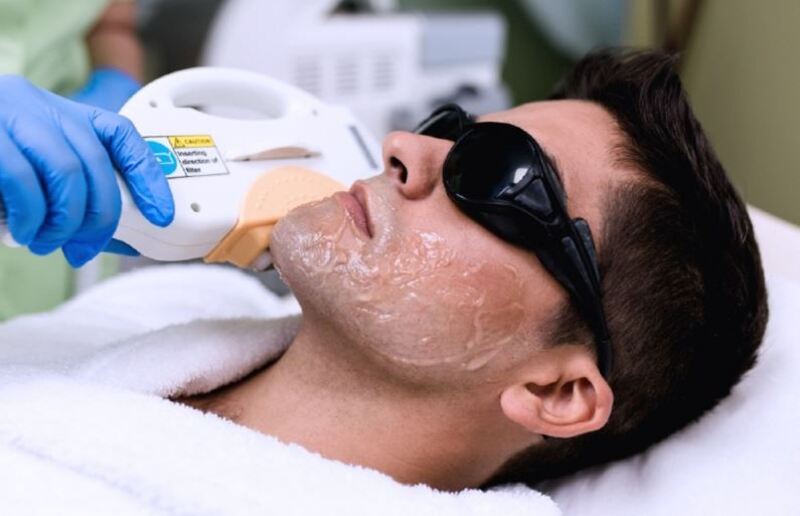 triet-rau-quai-non-3